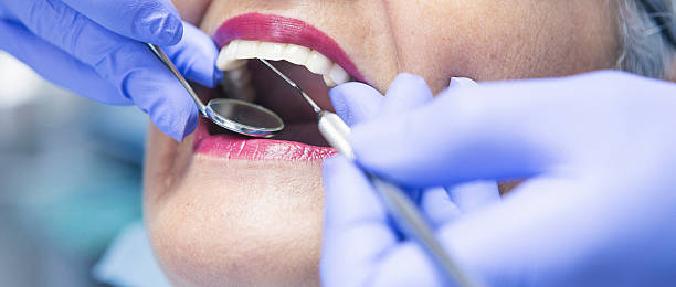 Best Urgent Care for Lost Fillings or Crowns in River Road, NC